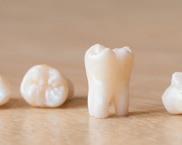 weisheitszaehne_2_rk1_5928_small