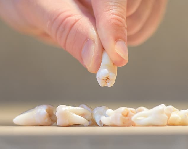 zahnentfernung_rk1_6411_small_sq